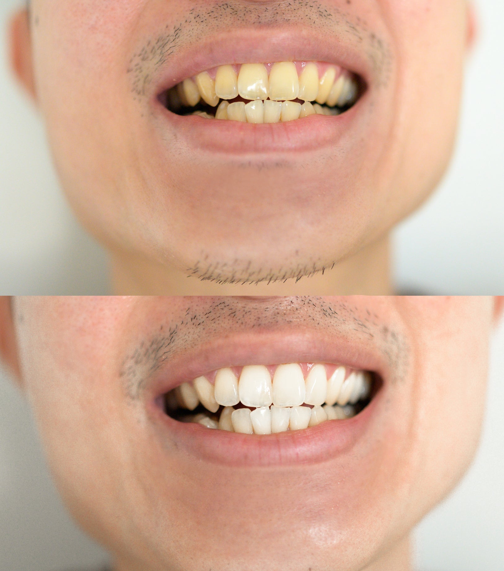 HIRA Daily Purity Bar